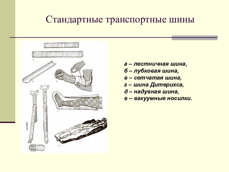 Подручные и табельные средства транспортной иммобилизации