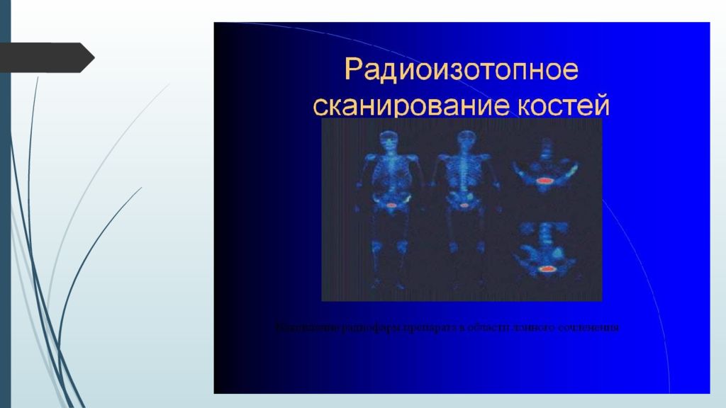 Участие медсестры в инструментальных методах исследования презентация