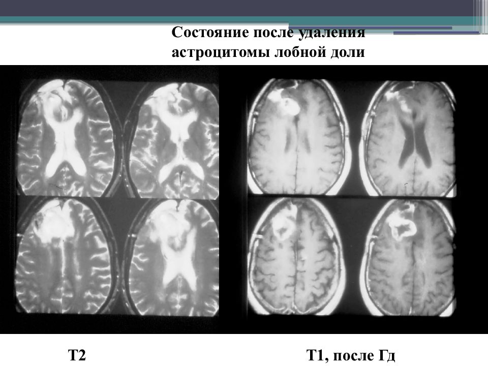 мрт фотоснимки. самочувствие после мрт. мрт и рентген излучение. зачем нужен мрт позвоночника. самочувствие после мрт.