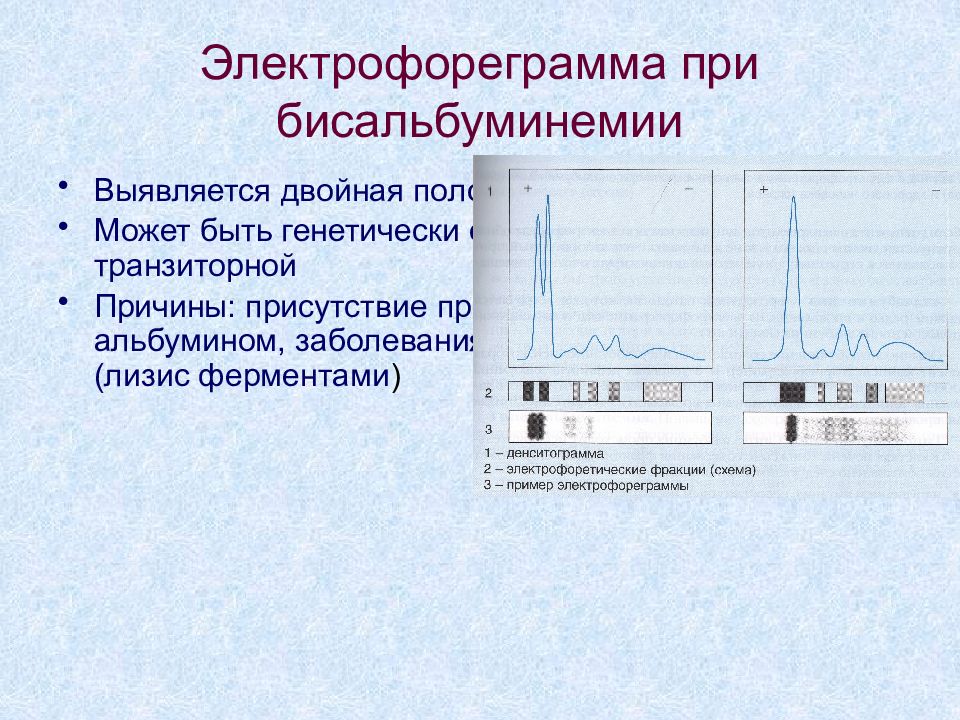 Электрофорез белков биохимия.