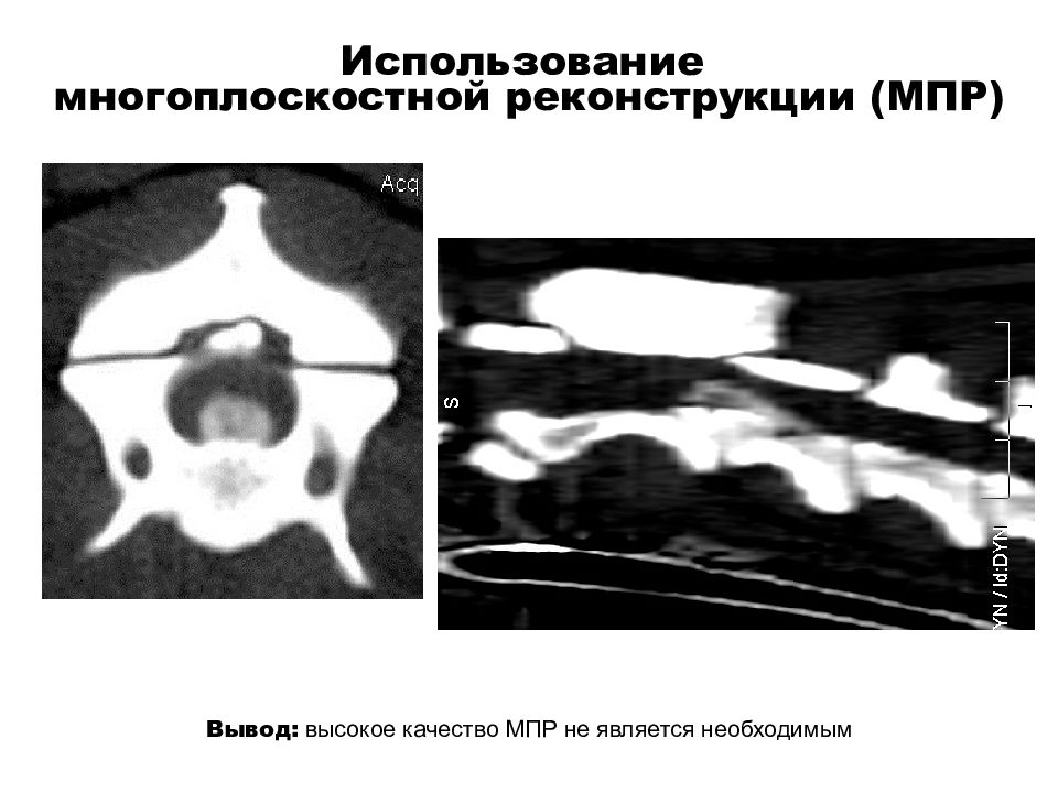 Реконструкция изображений в компьютерной томографии