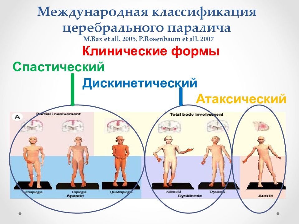 Формы дцп картинки