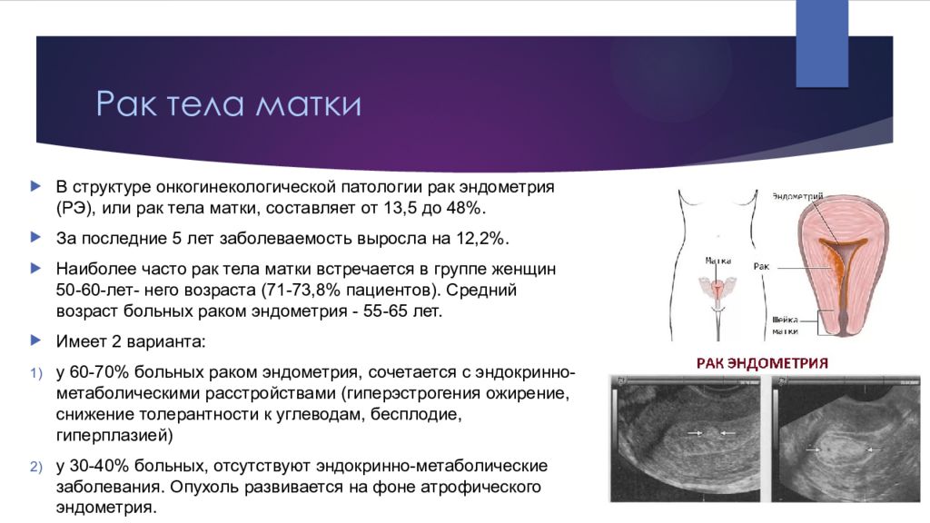 Рак тела матки. Новообразований тело матки размером 55*44.