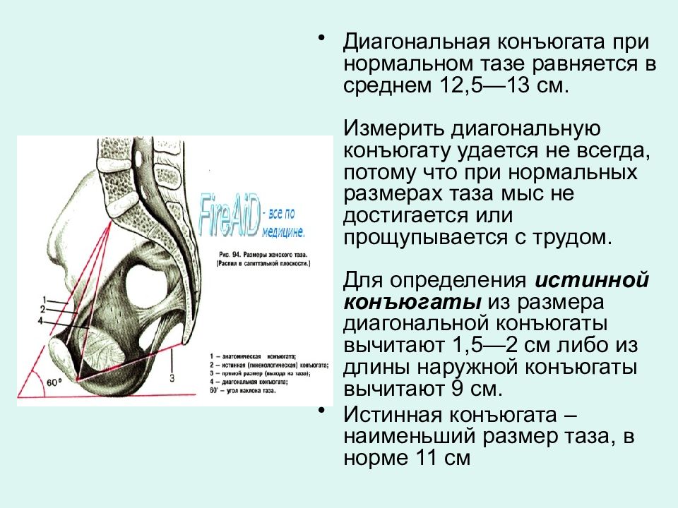 Размеры женского таза презентация