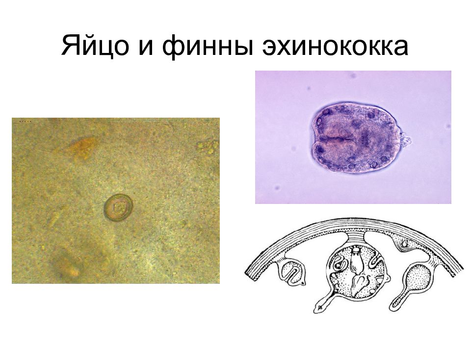 Яйца Эхинококка Фото