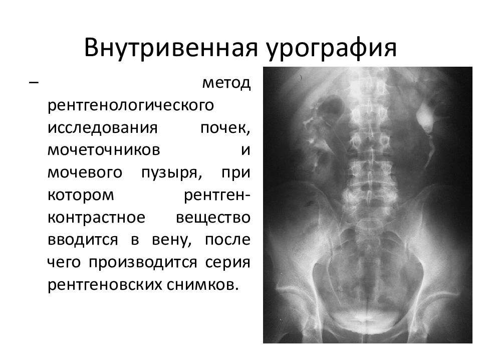 Это рентгенологическое исследование с регистрацией неподвижного изображения на специальной