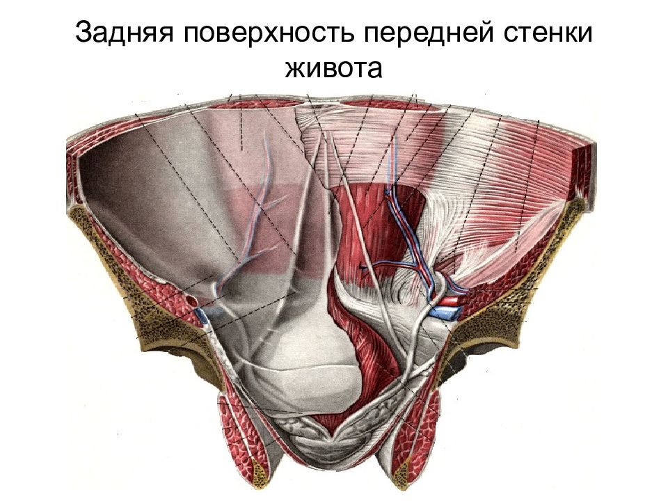 Границы переднебоковой стенки