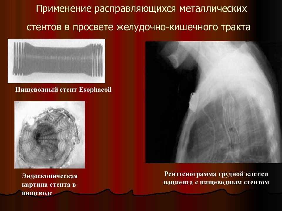 Интервенционная радиология презентация