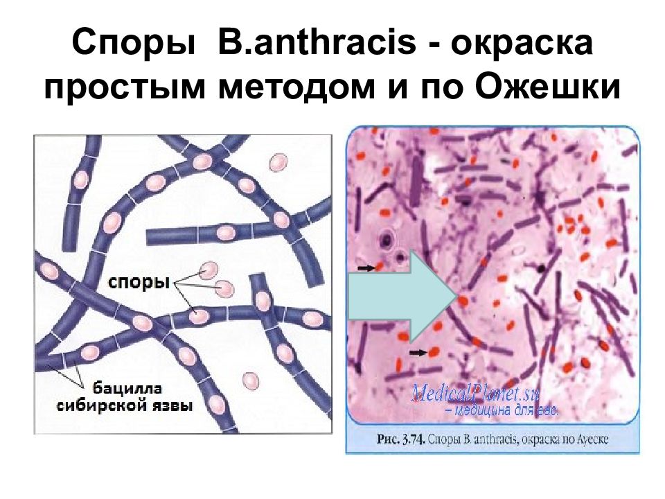 Споры сибирской язвы сохраняются