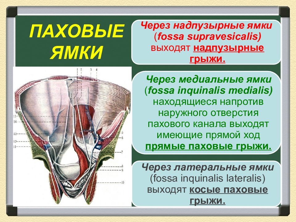 Грыжи малого таза. Медиальная ямка пахового канала. Паховые каналы топографическая анатомия. Латеральная паховая я ка. Паховые ямки топографическая анатомия.