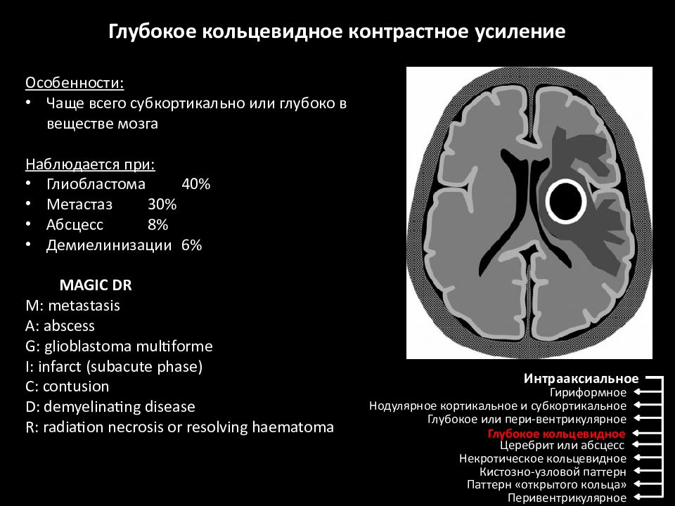 Мрт дифференциальная диагностика