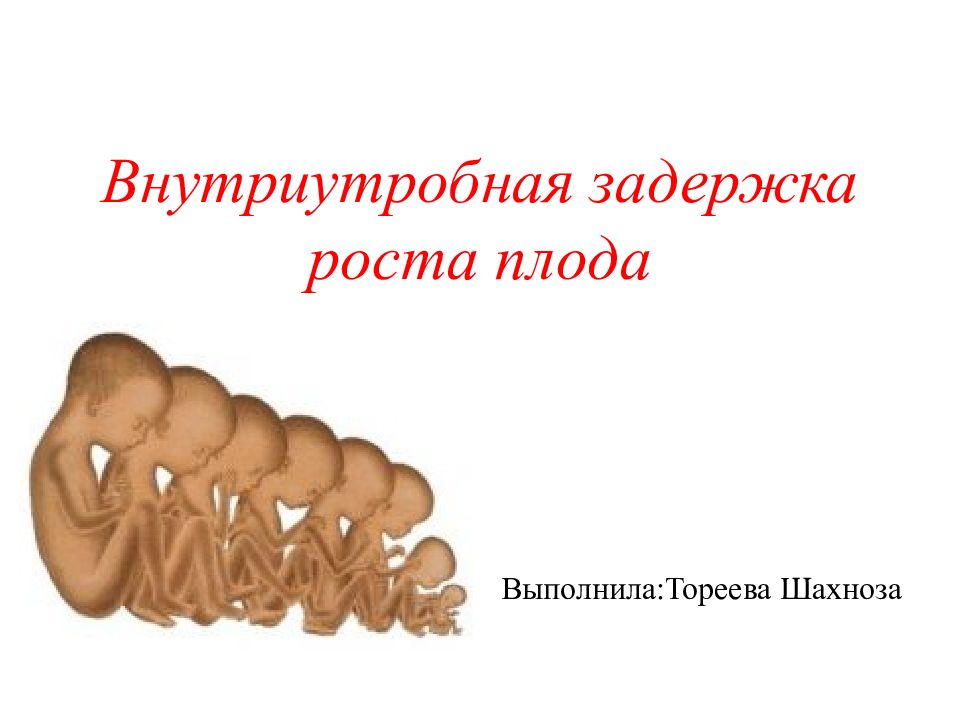 Задержка роста. Внутриутробная задержка роста. Синдром задержки внутриутробного роста плода. Задержка развития плода рисунок. Задержка внутриутробного роста, развития плода..