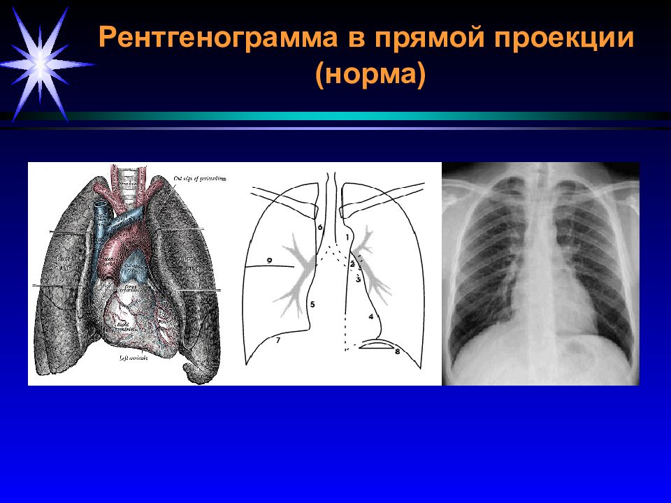 Рентгенография в прямой проекции. Лучевая диагностика ССС. Проекции в лучевой диагностике. Проекции в рентгенологии человека. Лучевая диагностика ССС презентация.