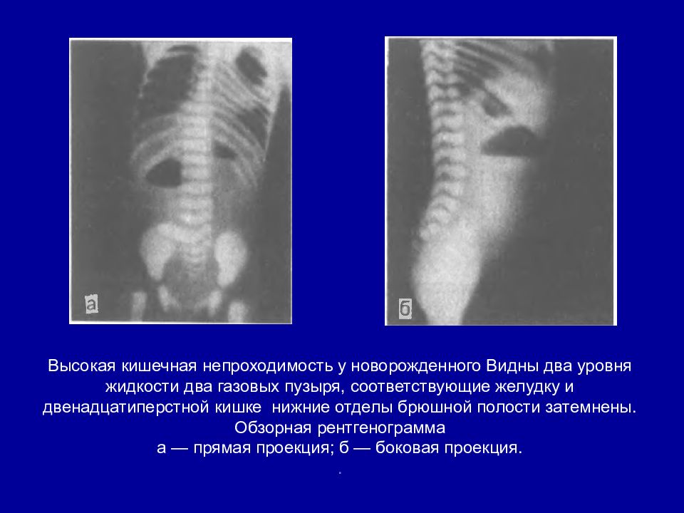 Локальный статус кишечная непроходимость карта вызова