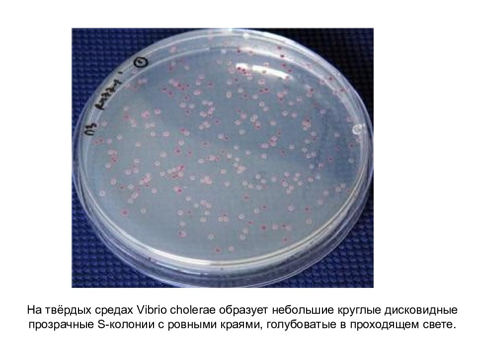 Холерный вибрион презентация микробиология