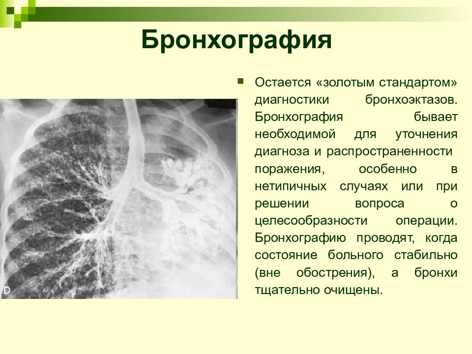 Лучевая диагностика органов дыхания презентация