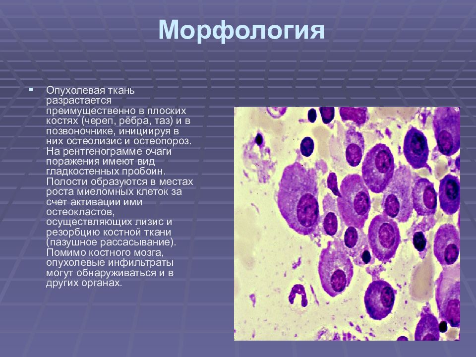 Гемобластозы это. Гемобластозы — заболевания кроветворной ткани:. Гемобластозы морфология. Гемобластозы классификация. Гемобластозы с первичным поражением костного мозга.