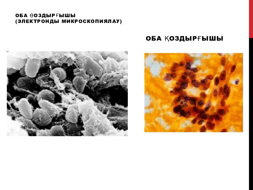 Пневмония ауруы презентация