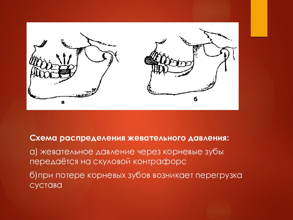 Определение центрального соотношения челюстей при полном отсутствии зубов презентация