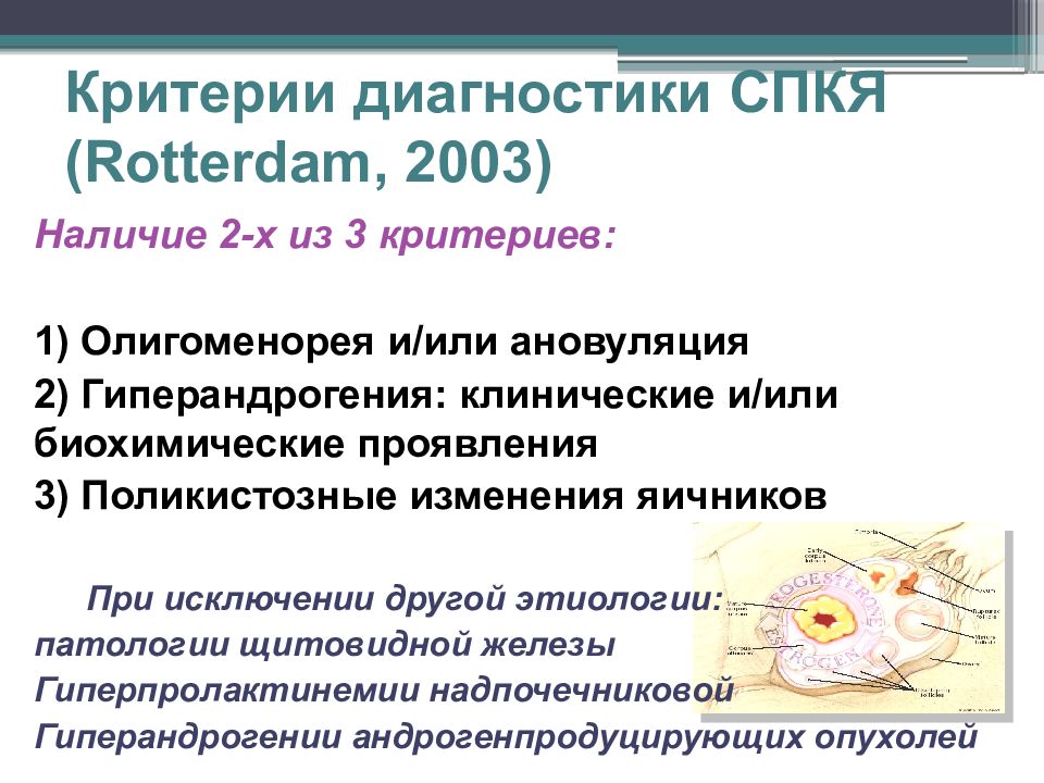 Синдром поликистозных яичников. Критерии диагностики СПКЯ (Роттердам, 2003). Роттердамские критерии диагностики СПКЯ. Диагностические критерии СПКЯ. Критерии синдрома поликистозных яичников.