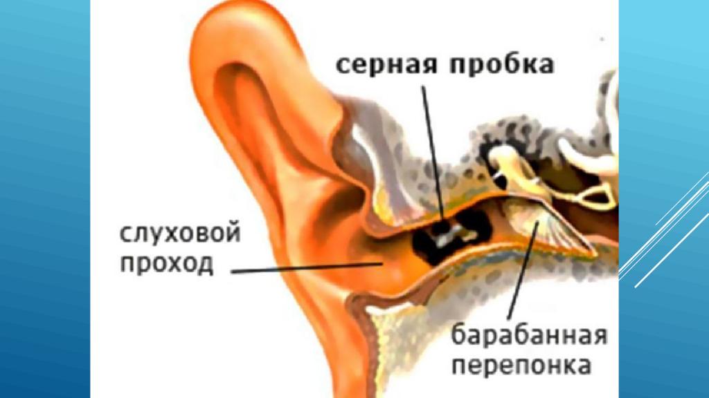 Почему образуются пробки в ушах. Ухо строение серная пробка. Ушная сера в барабанной перепонке. Строение человеческого уха серная пробка. Строение уха человека серная пробка.