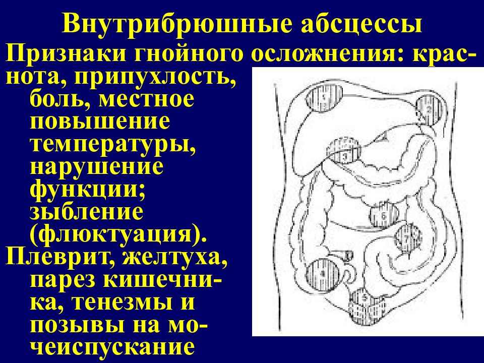 Острые процессы в брюшной полости у новорожденных презентация