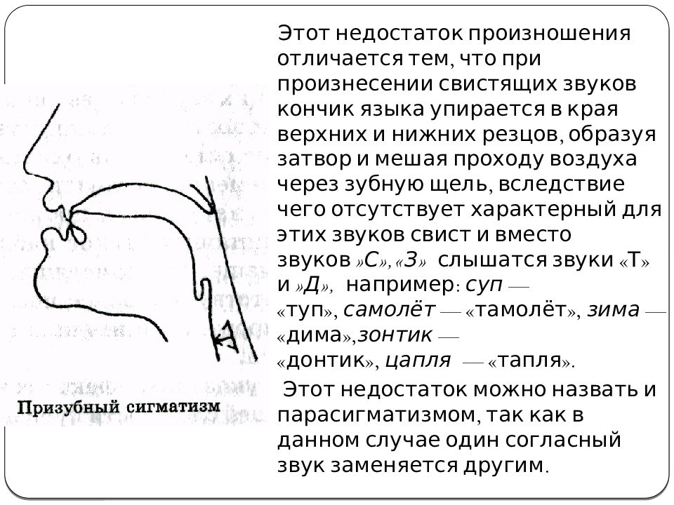Сигматизм шипящих Сигматизм шипящих