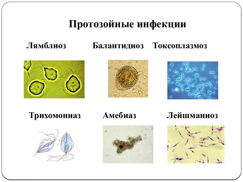 Протозойные инфекции презентация
