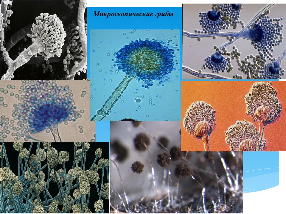 Микроскопические грибы. Спорообразование микроскопических грибов. Многоклеточный микроскопический гриб это. Микросокпически егрибы. Споры микроскопических грибов.