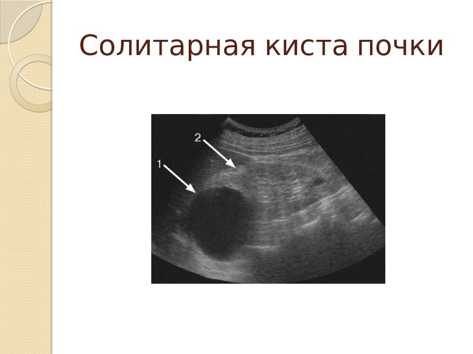 Презентация на тему узи