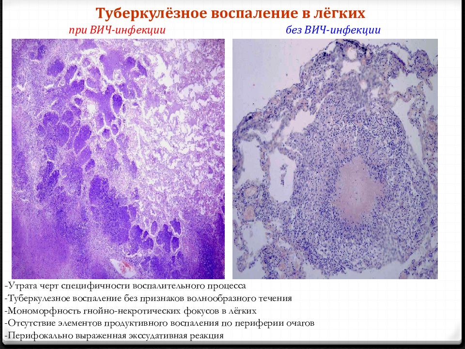 Вич патологическая анатомия презентация