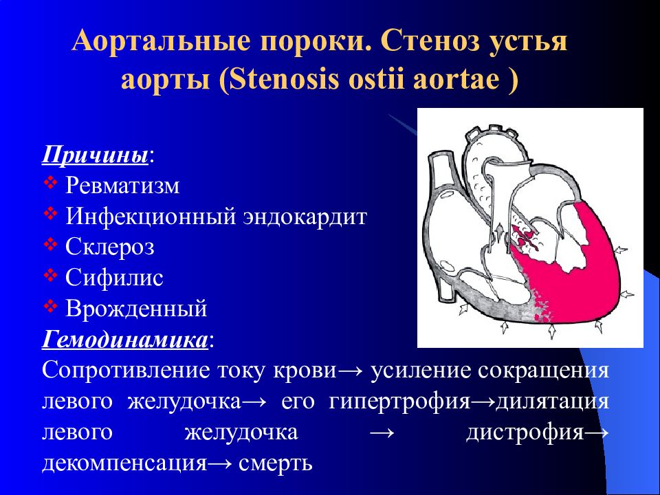 Диагностика пороков сердца картинки