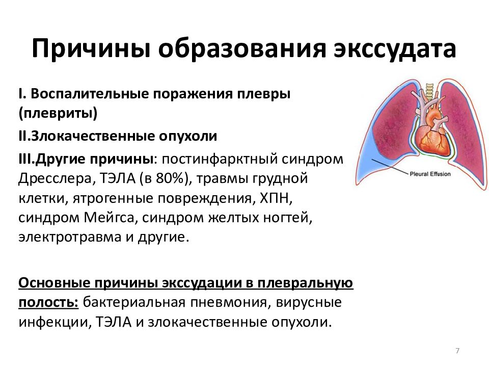 Плевральный выпот презентация