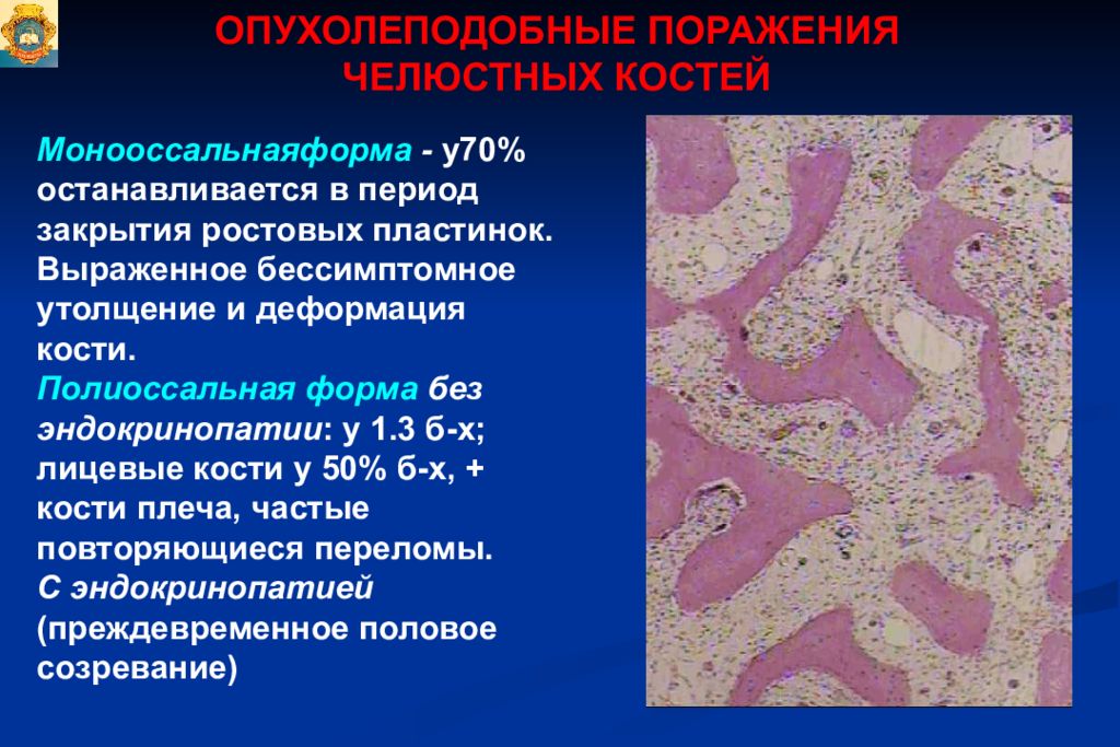 Опухоли опухолеподобные поражения и кисты кожи лица презентация