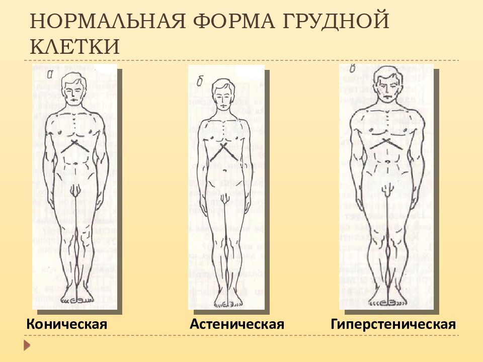 Формы грудной клетки. Гиперстеническая форма грудной клетки у женщин. Астенический Тип грудной клетки. Форма грудной клетки нормостеника. Формы грудной клетки нормостеническая астеническая.