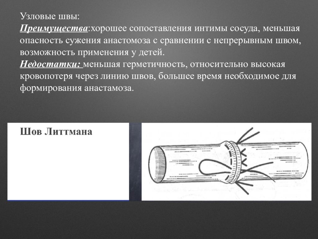 Сосудистый шов история. Сосудистая хирургия презентация. Боковой сосудистый шов.