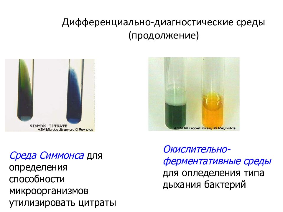 Сахаролитические свойства бактерий. Среда Ресселя дифференциально диагностическая. Дифференциально-диагностические среды Олькеницкого. Среда Симмонса микробиология. Дифференциально-диагностические среды микробиология.