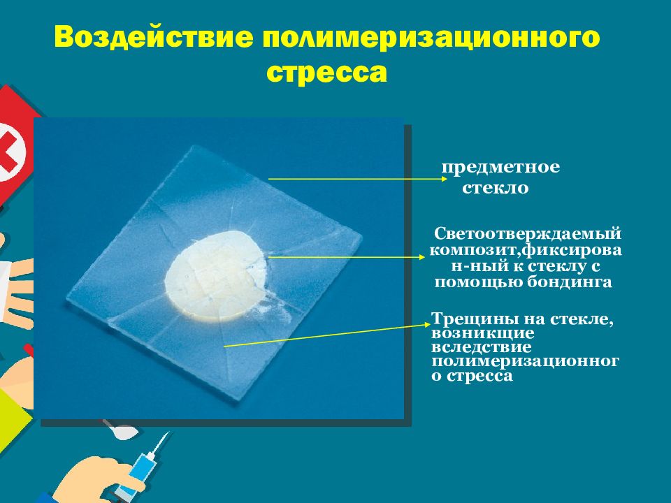 Современные пломбировочные материалы в детской стоматологии презентация