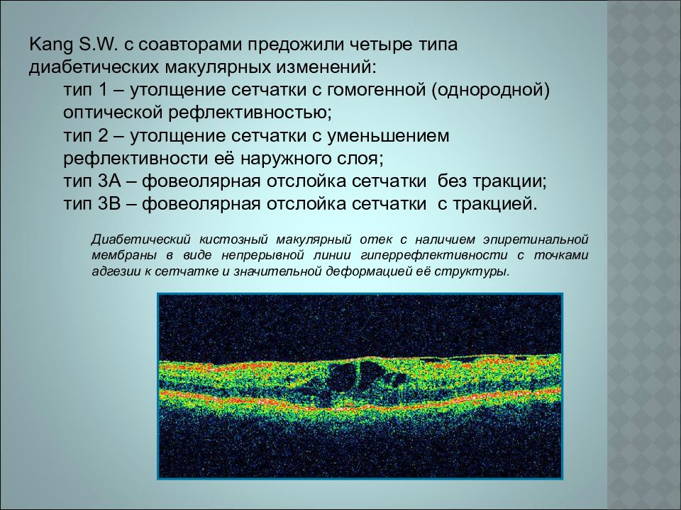 Окт. Оптическая когерентная томография норма. Оптическая когерентная томография сетчатки. Оптическая когерентная томография слои сетчатки. Оптическая когерентная томография макулярной области.