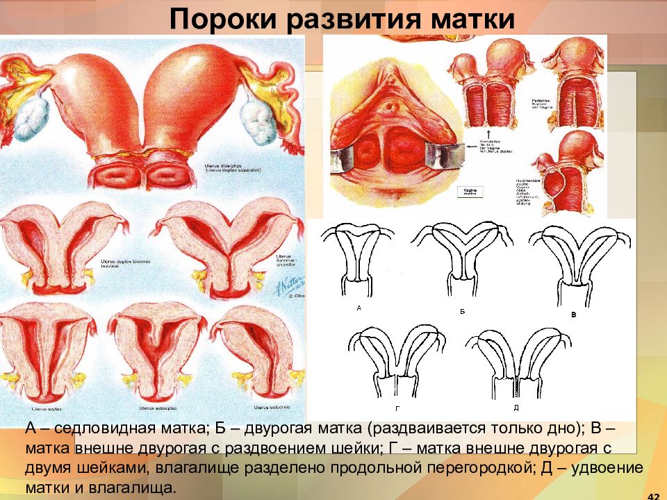 Аномалии Малых Половых Губ Фото