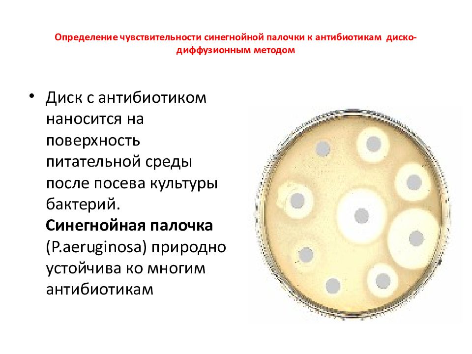 Посев на определение чувствительности. Чувствительность к антибиотикам диско-диффузионным методом. Методы определения чувствительности к антибиотикам. Метод дисков для определения чувствительности к антибиотикам. Методы определения чувствительности микроорганизмов к антибиотикам.