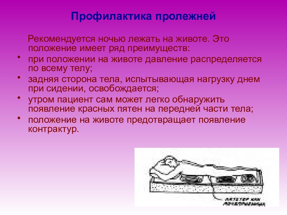 Профилактика пролежней тест. Профилактика от пролежней. Профилактика образования пролежней. Меры профилактики пролежней. Положение тела при профилактике пролежней.