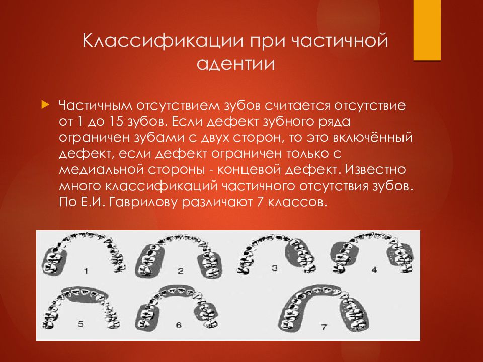 Определение центральной окклюзии при частичном отсутствии зубов презентация