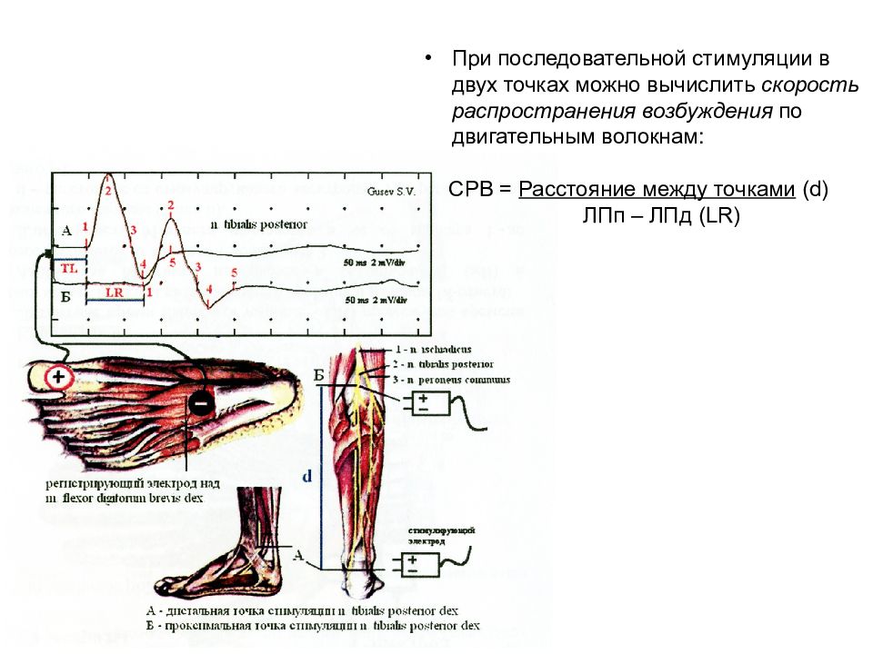 Диагностика нервов. Скорость возбуждения мышцы и нерва. Стимуляция мышцы схема. Двигательная точка нерва и мышцы. Функциональная диагностика мышц.