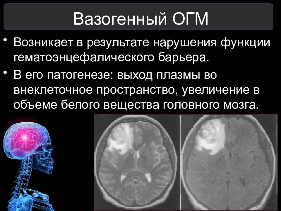 Отек мозга презентация