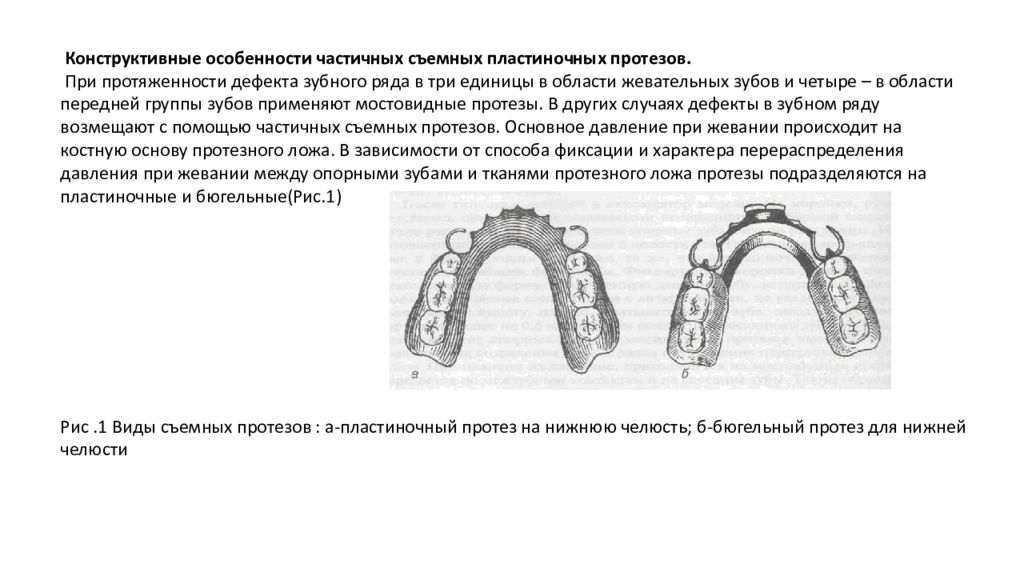 Технология изготовления съемных пластиночных протезов презентация