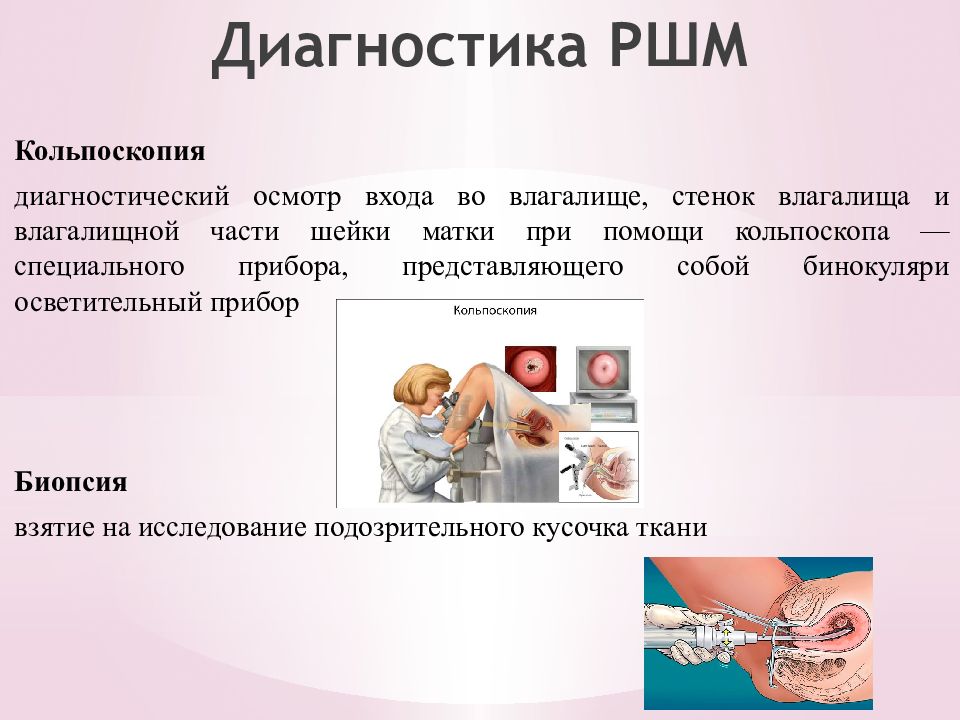 Диагностика рака шейки матки презентация