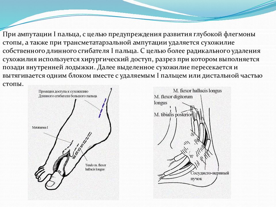 Диабетическая стопа карта вызова