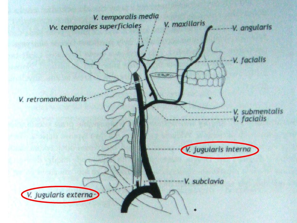 Норма внутренней яремной вены. Притоки внутренней яремной вены схема. Схема внечерепных притоков внутренней яремной вены. Внутренняя яремная Вена притоки. Наружная и внутренняя яремная Вена.
