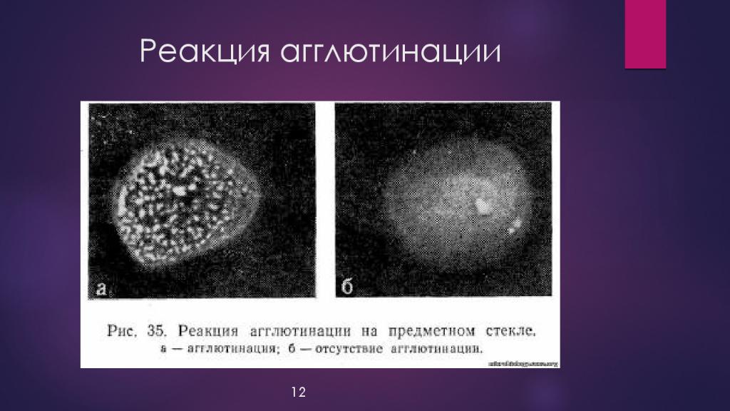 Реакция на стекло. Реакция агглютинации сальмонелл. Ориентировочная реакция агглютинации микробиология. Реакция агглютинации сальмонеллез. Реакция агглютинации на стекле микробиология.